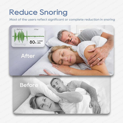 Magnetic Universal Nasal Strips | Breathing Nasal Strip | Anti Snoring Nose Clip | Skin Safe Sleep Nasal Strips | Nasal Dilators For Breathing | Starter Kit (15 Count)